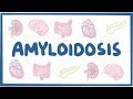 Amyloidosis - causes, symptoms, diagnosis, treatment, pathology Amyloidosis - causes, symptoms, diagnosis, treatment, pathology