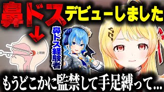 鼻ドスデビューした結果、治療が嫌すぎて極論にたどり着く奏ちゃんｗｗｗ【ホロライブ切り抜き/音乃瀬奏/星街すいせい/ReGLOSS/DEV_IS】