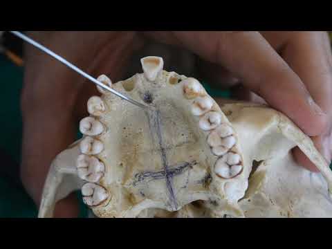 Osteologie der Norma Basalis Teil 1