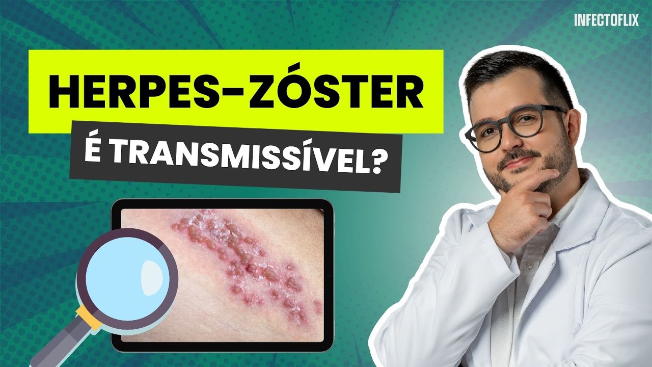 Bruno Fernando Buzo-0