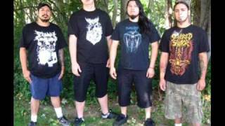 Download lagu Disfigured 'Vehicular Vesectomy' mp3