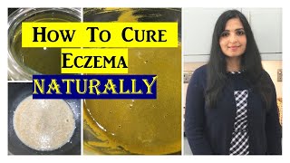 Best Home Remedy For Eczema ⭐| #HomeRemediesforEczema | Samyuktha Diaries