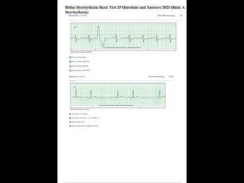 Dysrhythmia Basic A 35 Questions