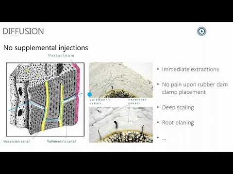 QuickSleeper5 - IO Express Clinical Training