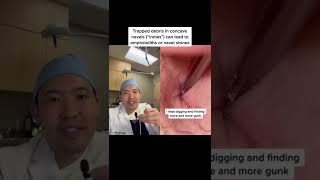 #shorts Dermatologist Reacts to Dirty Belly Button Extraction