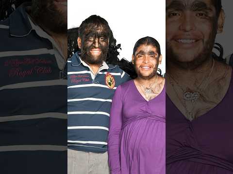 This is the world's hairiest family 👀