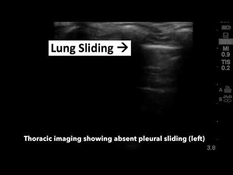Pediatric Anesthesia May 2019 Part 3