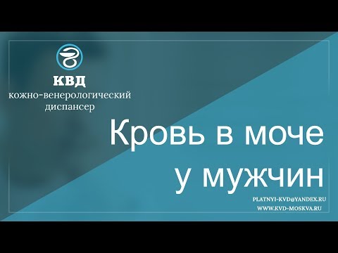 Лечение остеохандроза шеи Лечение пиявками суставов схема