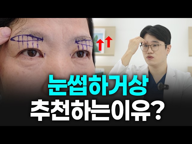 요즘 인기 많은 중년 눈성형 "눈썹하거상" 왜 찾는 걸까요?