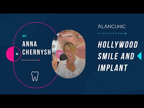 Alan Clinic : Mrs Anna Chernysh traveled from belgium to get a Hollywood Smile and implant in Turkey