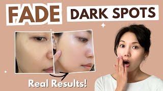 How to Fade Dark Spots on Face and Hyperpigmentation: Ultimate Routine to Even Out Skin Tone