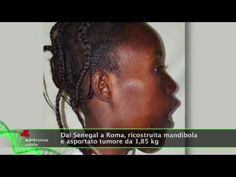 Emorroidi impotenza Us Polvere di guida cavallo patogeno