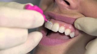 How to use an interdental brush - AJ Hedger