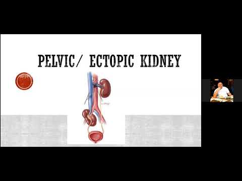 VMMC Campbell lecture series: Fundamentals of Upper urinary tract drainage; Lap and robotic Uro Sx