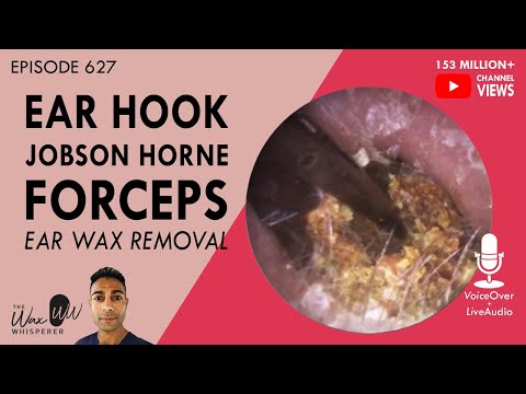 627 - Ear Hook, Jobson Horne & Forceps Ear Wax Removal