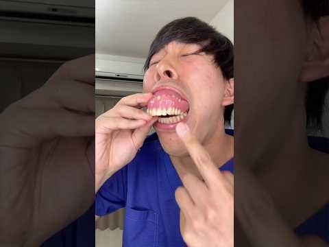 入れ歯を同時に3つ入れると&hellip;
