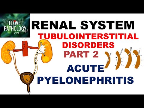 ACUTE PYELONEPHRITIS- Pathology