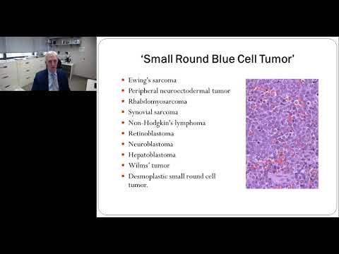 RNA-seq for the Detection of Gene Fusions in Tumors
