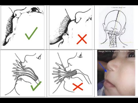 Breastfeeding Duration: A Complex Interplay of Factors