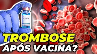 COVID: VACINA DE OXFORD ASTRAZENECA CAUSA TROMBOSE ???
