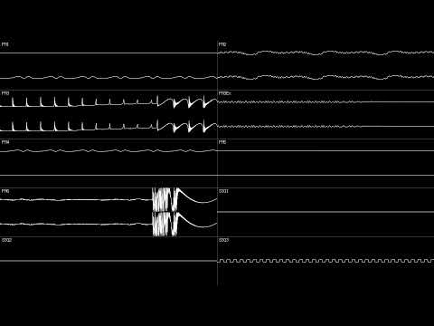 PC-98 - "Love Escalator - Rocket Punch" by Tadayuki Itou - Oscilloscope View