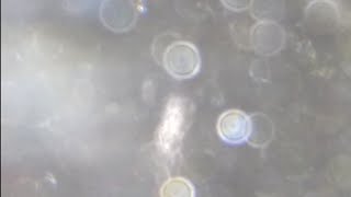 Video The Cure! (5676977) P.1 Of two. READ THE DESCRIPTION!