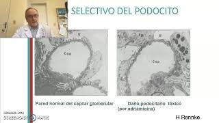 Síndrome nefrótico. Dr. Noboa