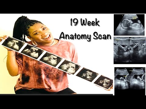 19 Week Ultrasound | Anatomy Scan | Vlog