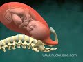 El nacimiento de un Bebé en 3D
