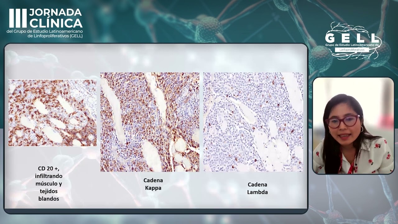 Sally Rose  Paredes Noguni-1