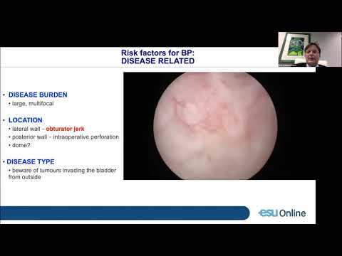 Urowebinar: Bladder Cancer TURB