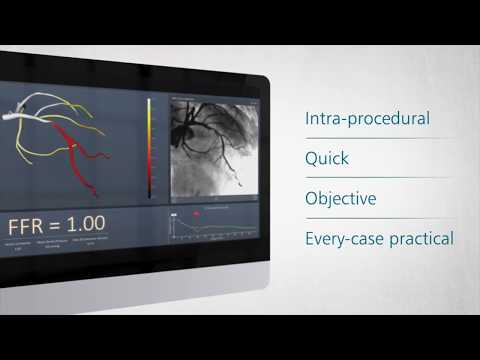 Introducing The CathWorks FFRangio™ System