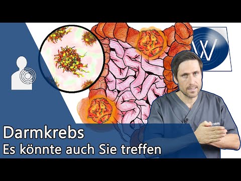 Darmkrebs: Was wir dagegen tun können & worauf wir achten müssen – Ursachen, Symptome & Therapie