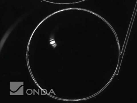 Ultrasound Image of Waves Hitting Large Aluminum Tube