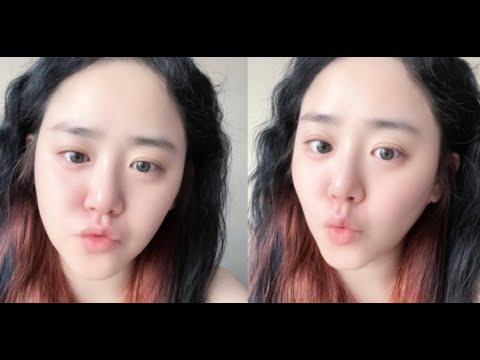 Moon Geun Young shares first selfie in 7 months after rare disease recovery