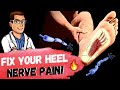 Nerve Heel Pain SECRETS [Plantar Fasciitis vs. Baxter's Nerve]