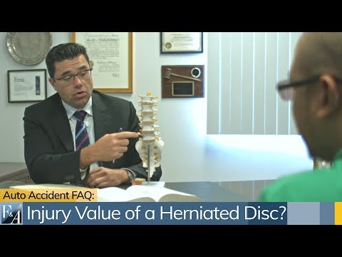 download lagu mp3 mp4 Car Accident Lawyer Brooklyn Ny, download lagu Car Accident Lawyer Brooklyn Ny gratis, unduh video klip Car Accident Lawyer Brooklyn Ny