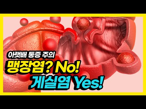 장염인줄 알고 병원을 찾았더니, 게실염 이라고?
