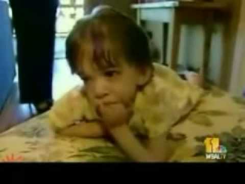 Video – Insólita historia de Brooke, la niña que quedó congelada como un bebé