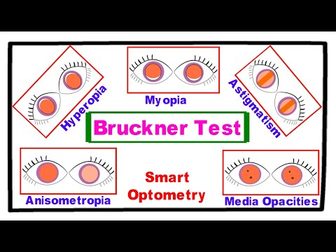 Bruckner Test - A Complete Tutorial