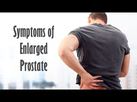 Prostate adenoma pathology outlines