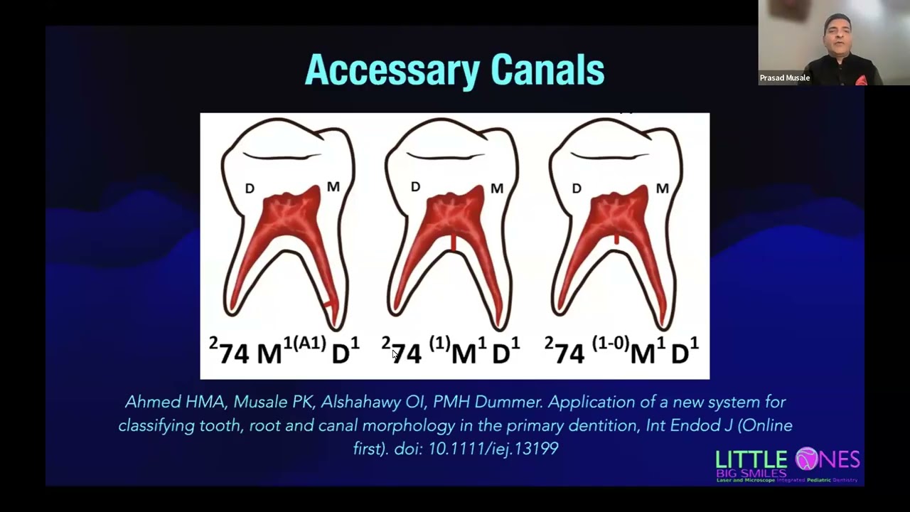 IAPD Webinar - Non Vital Pulp Therapies in Primary Teeth