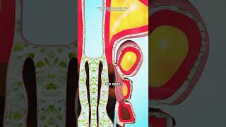 How Sinusitis Surgery Is Performed (3D Animation)