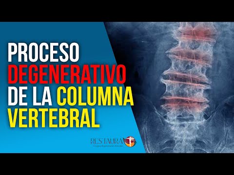 Dolor en el lado derecho de la espalda que se extiende al estómago El costo de la prótesis de rodilla