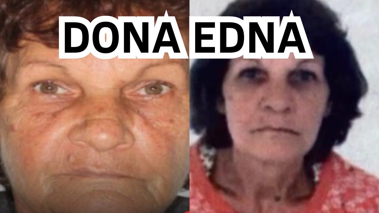 CASO VITÓRIA REGINA - PEÇAS IGUAIS OU DIFERENTES