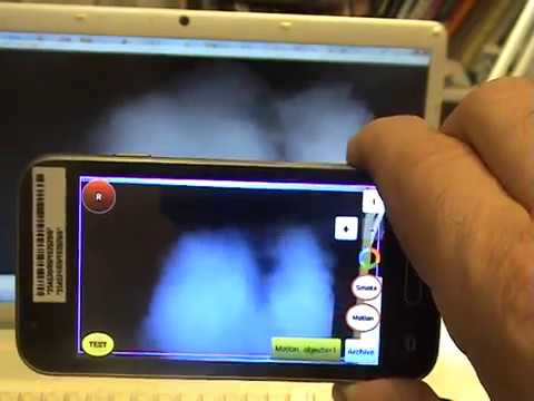 Smoke video detector & DropBox/ Google cloud drive Video