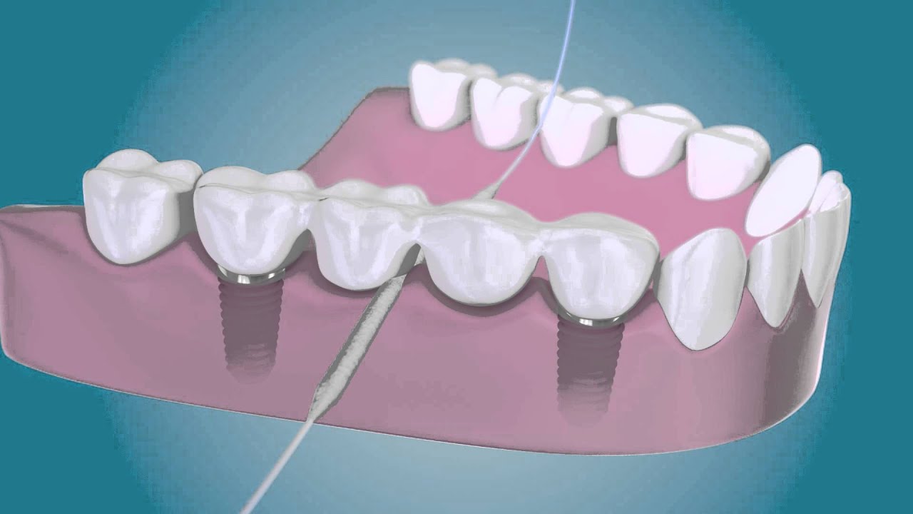 طريقة الأستعمال thumbnail