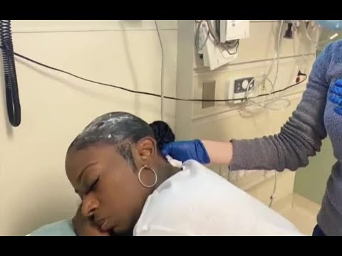 Woman who put Gorilla Glue in her hair gets free surgery