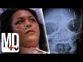 Her Parents Inserted PINS IN HER BRAIN As An Infant House M D MD TV