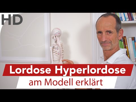 Nystagmus in Osteochondrose Starke Schmerzen an den Seiten des Halses